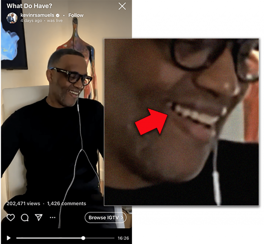 SHOCK PIC: Kevin ‘High Value Man’ Samuels Has A Missing Tooth!! (PICS)