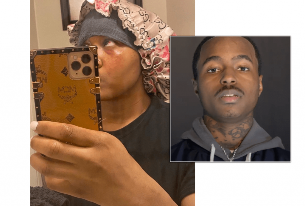 Rapper Popp Hunna BRUTALLY Beats His Girlfriend . . . She Leaks GRAPHIC Pics Of Abuse!
